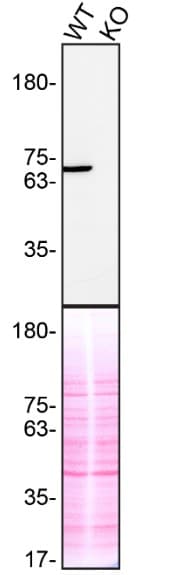 Syk Antibody Ep573y Ab40781  Western Blot Img430400