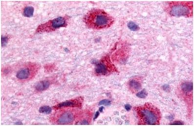 Edg8 Antibody N Terminal Ab140932  Immunohistochemistry Formalin Pfa Fixed Paraffin Embedded Sections Img59507