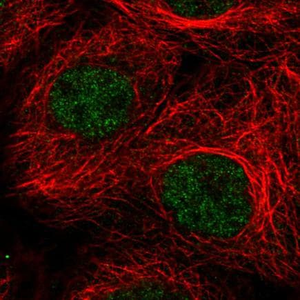 Anti-ATRX antibody [CL0537](AB188027)