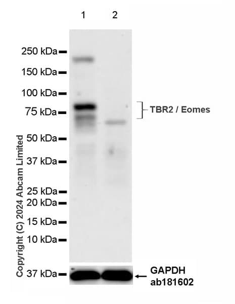 Anti-TBR2 / Eomes antibody [RM2055](AB319166)