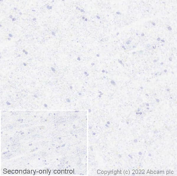 Anti-Estrogen Receptor alpha antibody [EPR4097](AB108398)