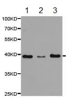 Psrc1 Dda3 Antibody Ab187199  Western Blot Img32632