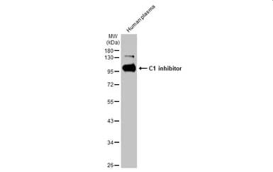 Anti-C1 inhibitor antibody [HL1196] - BSA and Azide free(ab313834)