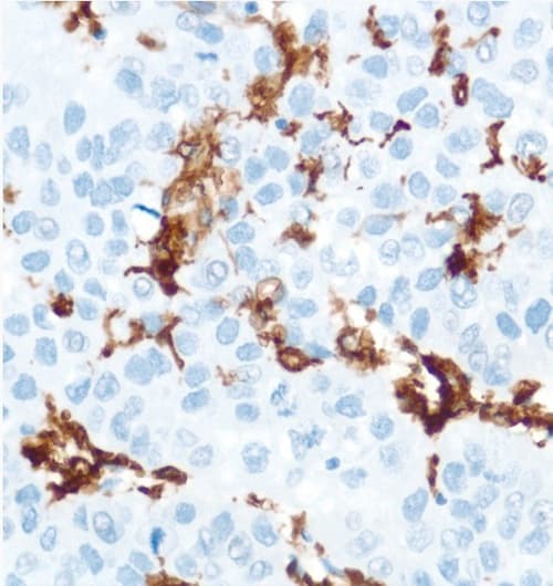 Cd16 Antibody Sp175 Ab183354  Immunohistochemistry Formalin Pfa Fixed Paraffin Embedded Sections Img59073