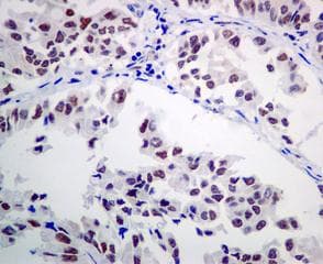 Ercc1 Antibody Epr7277 Ab129267  Immunohistochemistry Formalin Pfa Fixed Paraffin Embedded Sections Img44354