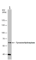Anti-Tyrosine Hydroxylase antibody(AB137721)