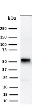 Anti-Cyclin E1 antibody [CCNE1/2460](AB238081)