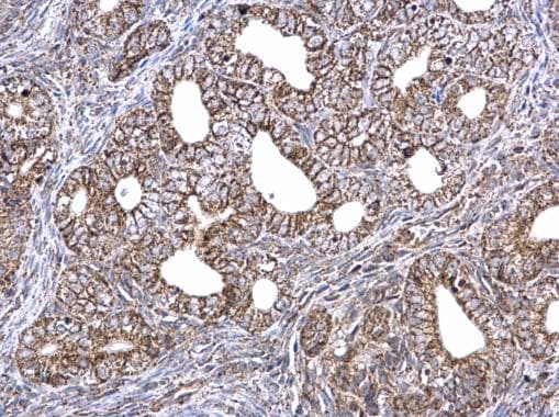 Etfa Antibody Ab153722  Immunohistochemistry Formalin Pfa Fixed Paraffin Embedded Sections Img44876