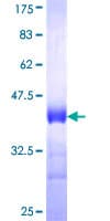 Recombinant Human MARCKS protein(AB152508)