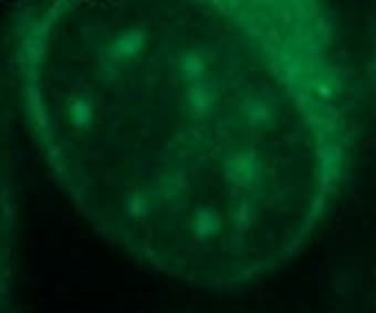 Anti-Hsp70 antibody [5A5](AB2787)