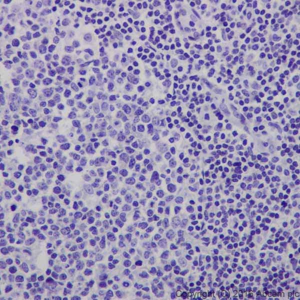 Anti-CRISPR-Cas9 antibody [EPR19620](AB202638)