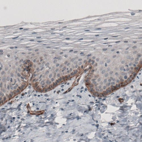 Anti-Laminin alpha 5/LAMA5 antibody [CL3118](AB210957)