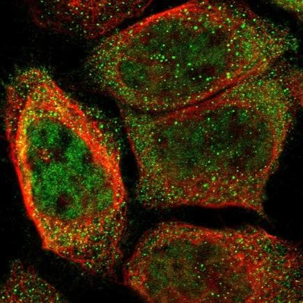 Orai3 Antibody Ab224095  Immunocytochemistry Immunofluorescence Img134699