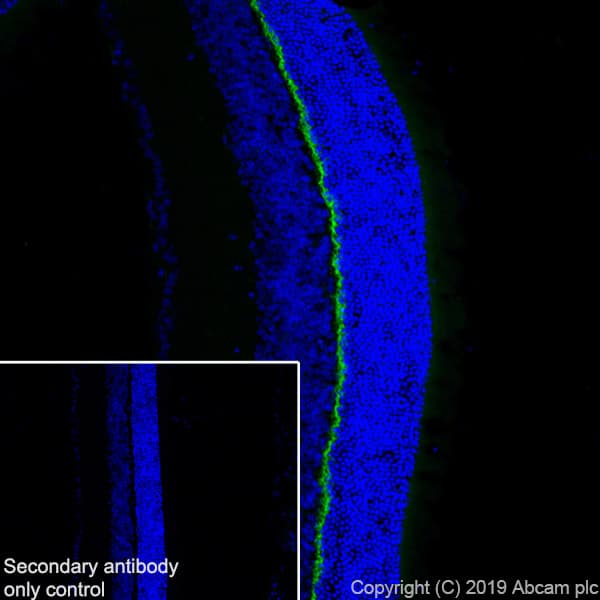 Anti-PSD95 antibody [EPR23124-118] - Synaptic Marker(AB238135)
