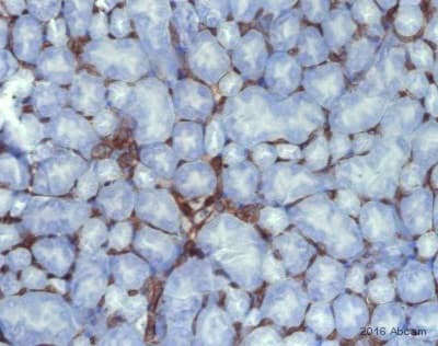 Anti-CD34 antibody [EP373Y](AB81289)