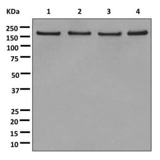 Anti-SF3B1 antibody [EPR11986](AB172634)