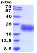 Ab208312  Sds Page Img92623