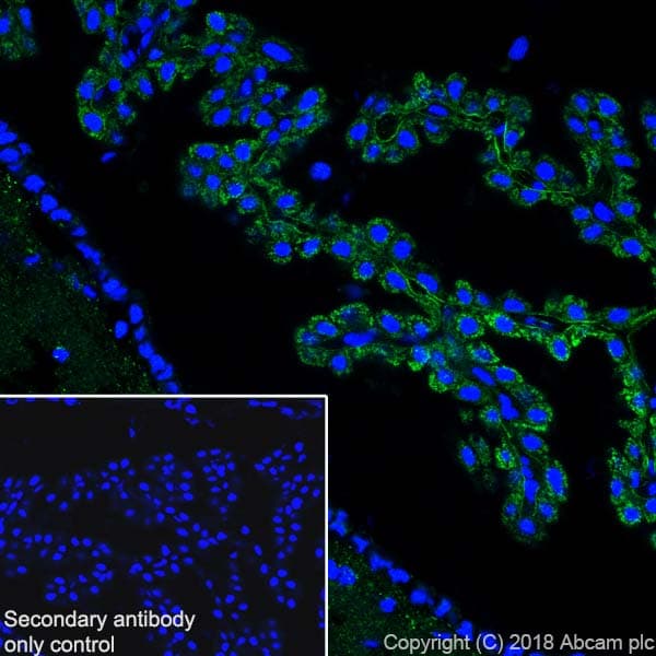 Abat Gaba T Antibody Epr20842 Bsa And Azide Free Ab233702  Immunohistochemistry Frozen Sections Img123411