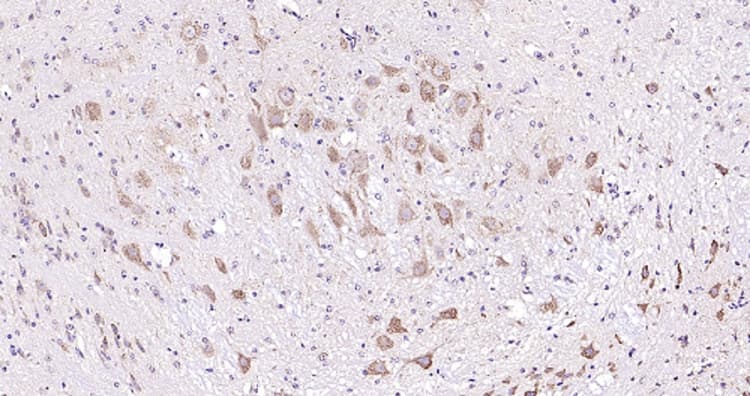 Anti-Melatonin Receptor 1B/MTNR1B antibody(AB203346)