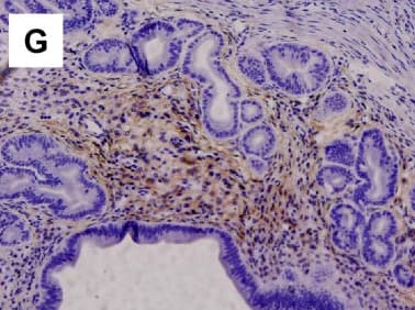 Anti-p75 NGF Receptor antibody [EP1039Y](AB52987)