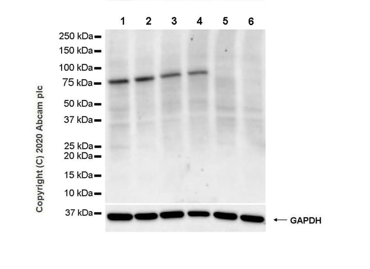 Anti-BTK antibody [10D11](AB254141)