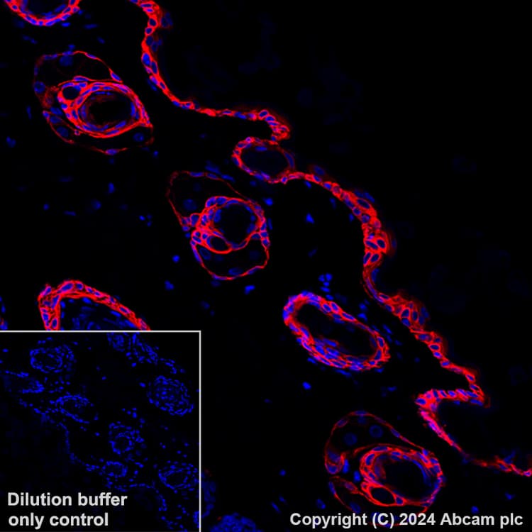 Alexa Fluor 647 Cytokeratin 5 Antibody Ep1601y Ab193895  Immunohistochemistry Formalin Pfa Fixed Paraffin Embedded Sections Img448922