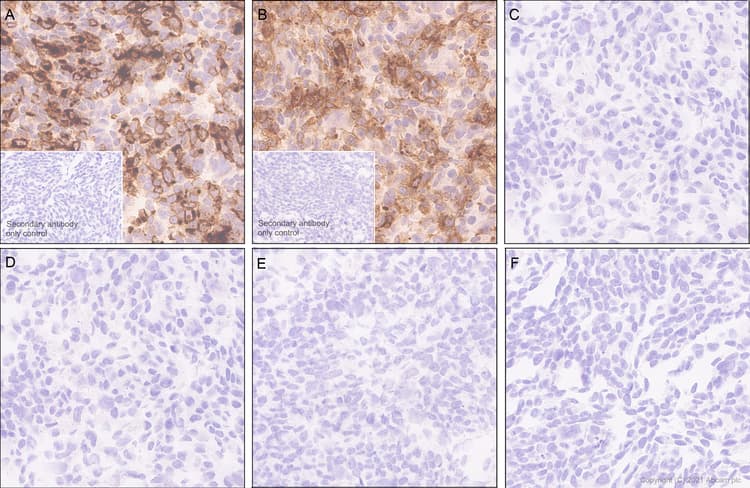 Anti-Ly6c antibody [EPR27220-23](AB314120)
