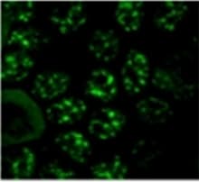 Anti-SC35 antibody [SC-35] - Nuclear Speckle Marker(AB11826)