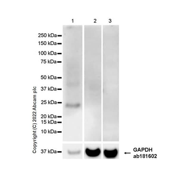 Anti-Aquaporin 5 antibody [EPR27474-70] - BSA and Azide free(AB305304)