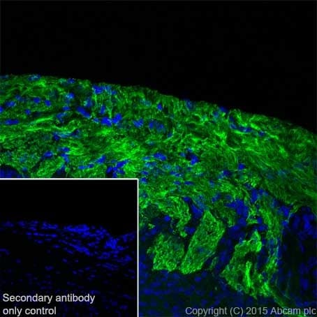 Olfactory Marker Protein Omp Antibody Epr19190 Bsa And Azide Free Ab250712  Immunohistochemistry Frozen Sections Img80319