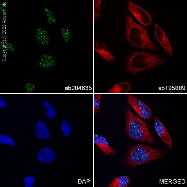 Alexa Fluor® 488 Anti-Histone H3 (tri methyl K9) antibody [EPR16601] - ChIP Grade(AB284635)