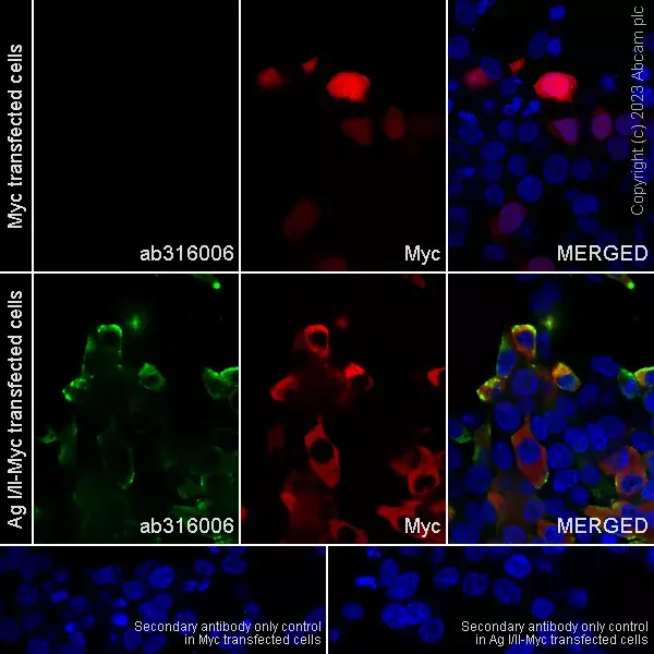 Anti-Streptococcus mutans Cell surface antigen I/II antibody [EPR28235-11](AB316006)