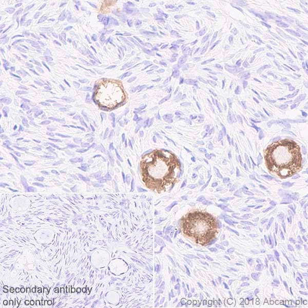Anti-DDX4 / MVH antibody [EPR21789] - BSA and Azide free(AB236462)