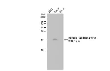 Human Papilloma Virus Type 16 E7 Antibody Hl1647 Ab308180  Western Blot Img407183