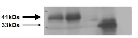 Anti-HLA Class 1 abC antibody [EMR8-5](ab70328)