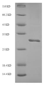 Recombinant Human ITIH5 protein (Tagged)(AB238235)
