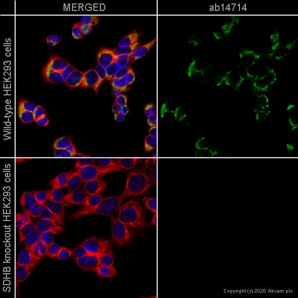 Anti-SDHB antibody [21A11AE7](AB14714)