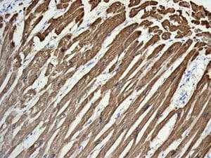 Anti-TNNC1 antibody [EPR9692(B)] - BSA and Azide free(AB248838)