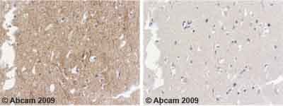 Alpha Internexin Antibody Ab7259  Immunohistochemistry Formalin Pfa Fixed Paraffin Embedded Sections Img72248
