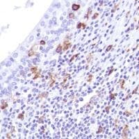 Anti-CD14 antibody [SP192](AB183322)