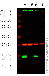 Anti-Ferritin heavy chain antibody [EPR3004Y](ab75973)