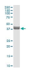 Anti-Inhibin beta E chain antibody(AB103167)