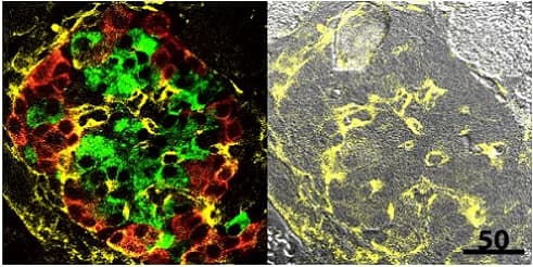 Anti-Collagen IV antibody(AB19808)