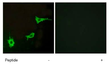 Endothelin A Receptor Et A Antibody Ab76259  Immunocytochemistry Immunofluorescence Img71489