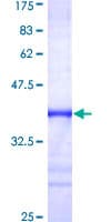 Recombinant Human FXR1 protein(AB152840)