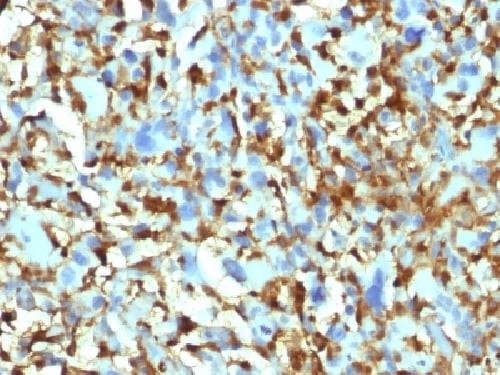 Anti-Factor XIIIa antibody [F13A1/1448](ab218392)
