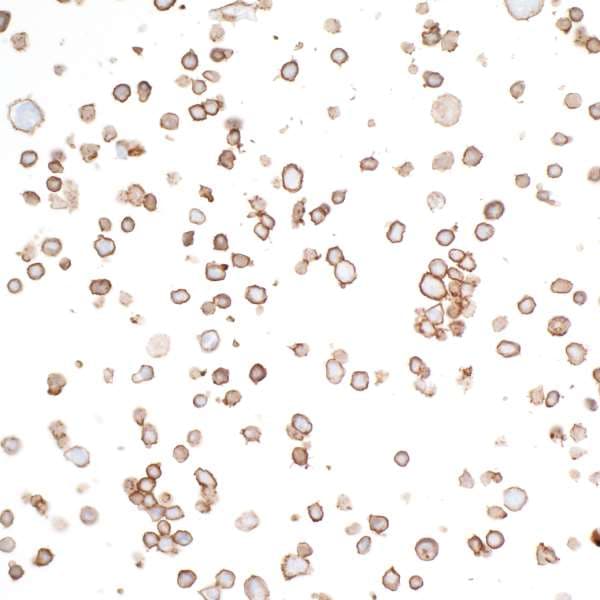 Anti-CD226 antibody [BLR063G] - BSA free(ab264415)