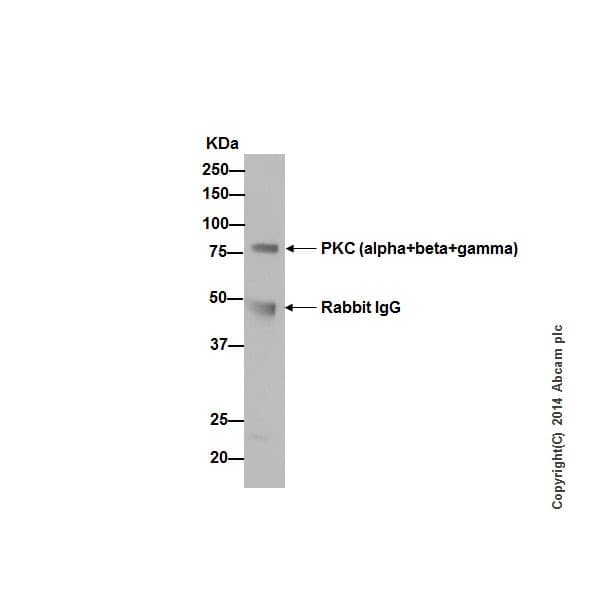 Pkc Antibody Epr16898 Ab179522  Immunoprecipitation Img523