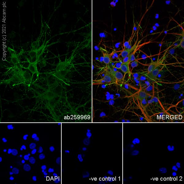 Anti-KCC2 antibody [EPR24203-85](AB259969)