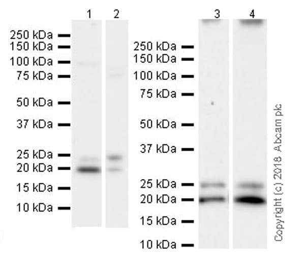 Anti-Proteasome 20S LMP2 antibody [EPR22042](AB242061)